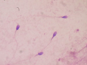 Stained human sperm in a laboratory. Image obtained from Wikimedia.org